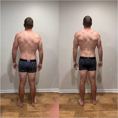 Before / After